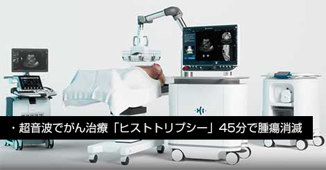 肝臓がん